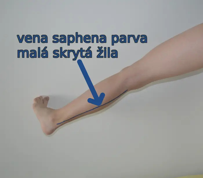 small saphenous vein